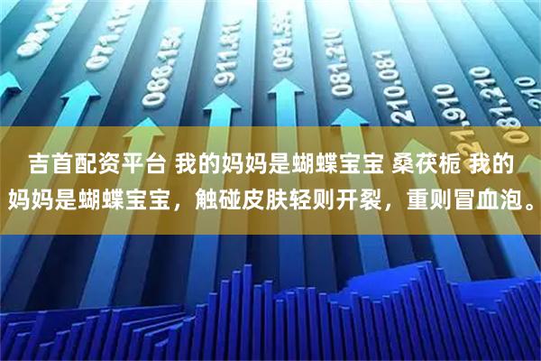 吉首配资平台 我的妈妈是蝴蝶宝宝 桑茯栀 我的妈妈是蝴蝶宝宝，触碰皮肤轻则开裂，重则冒血泡。